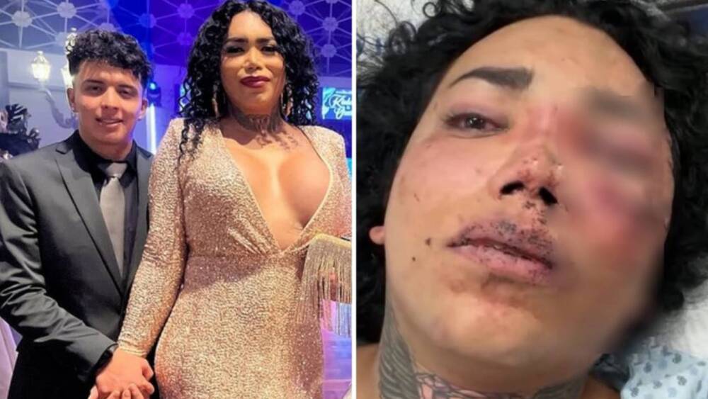 Paola-Suárez-a-punto-de-perder-el-ojo-y-con-dos-costillas-rotas-tras-terrible-golpiza-de-su-prometido.jpg