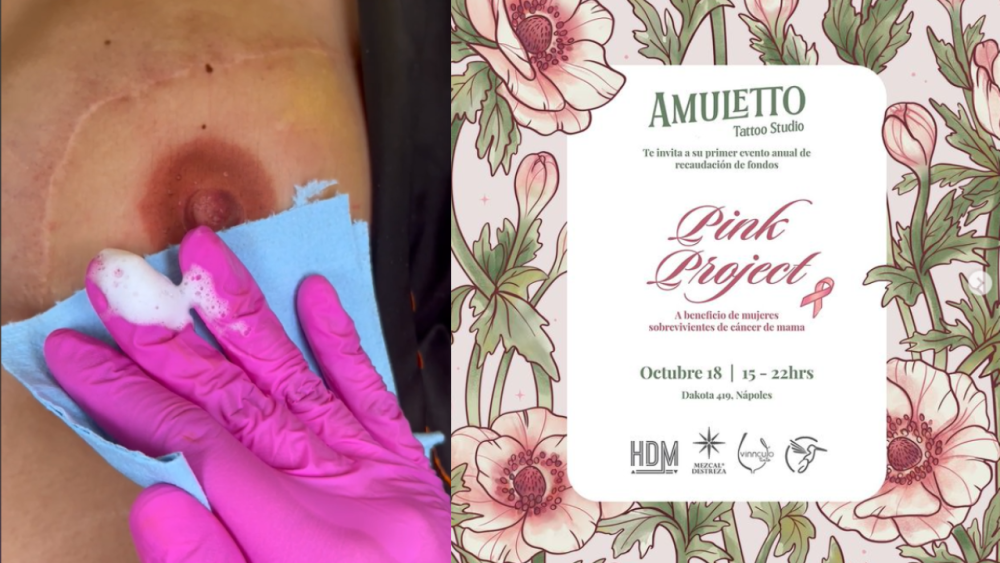 Andrea Nash y Javier Ibarreche unen fuerzas en Pink Project ¿Qué ocurre después del cáncer de mama.png