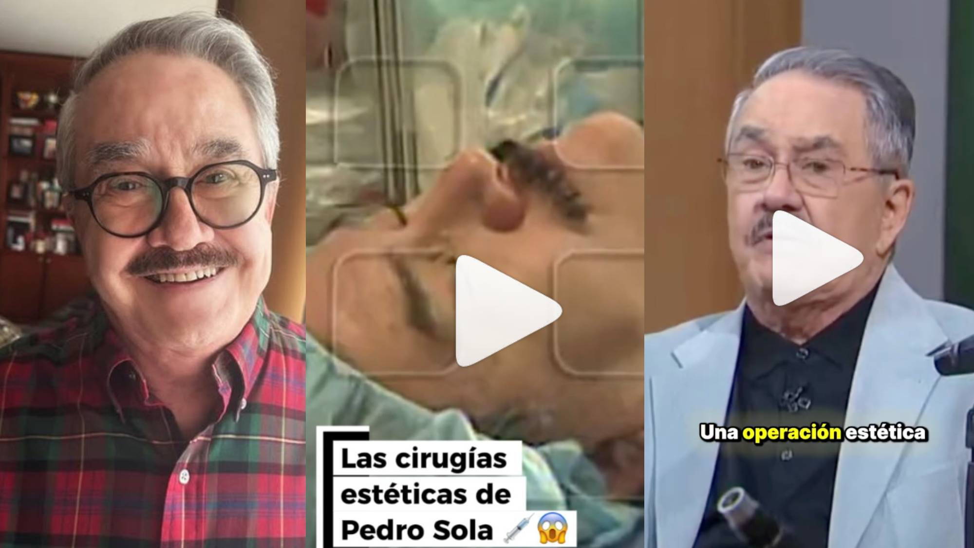 ¿Cuántas cirugías estéticas se ha hecho Pedro Sola? Él mismo se confiesa