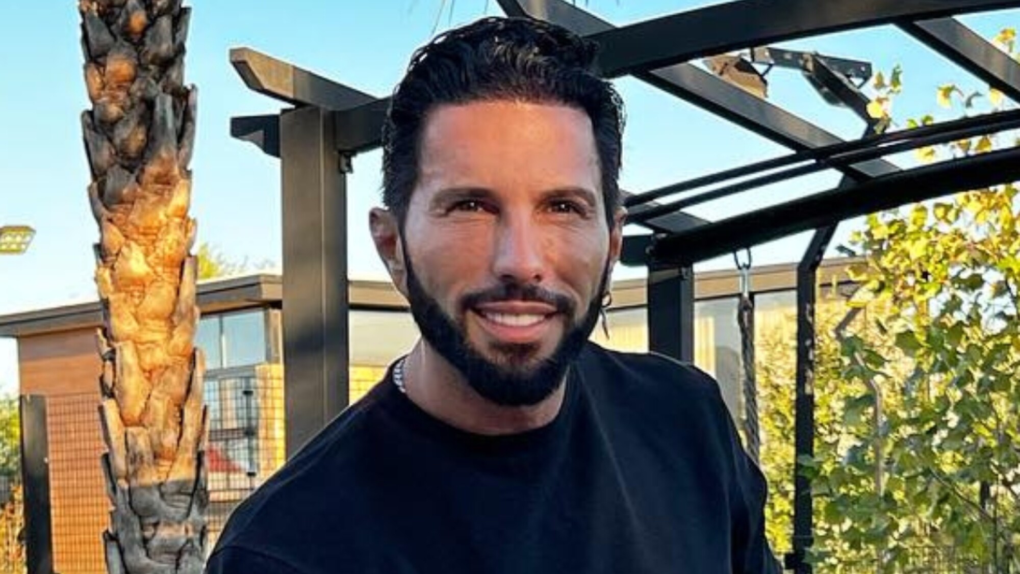 ¿Poncho de Nigris fue golpeado? La verdad acerca de la foto que publicó ¿Poncho de Nigris fue golpeado? La verdad acerca de la foto que publicó