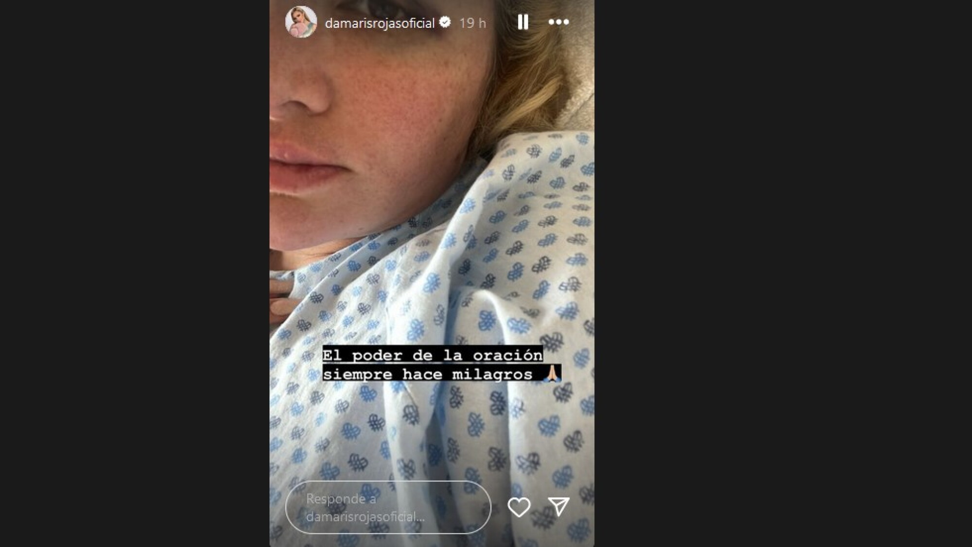 Damaris Roche ¿Quién es Damaris Rojas, la exconductora de Hoy que sufrió un fuerte ...