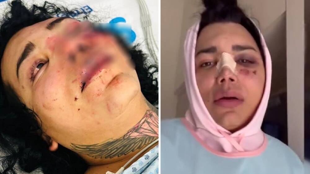 Paola-Suárez-reaparece-tras-dejar-el-hospital-Me-siento-mal-que-me-haya-hecho-esto-una-persona-que-quiero-video.jpg