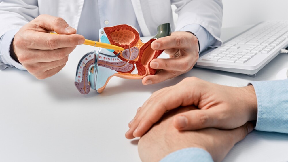 Prostate disease and treatment. Male reproductive system anatomical model in doctors hands close-up during consultation of male patient with suspected bacterial prostatitis